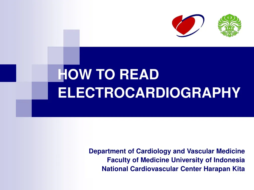 how to read electrocardiography