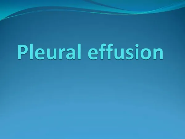 Pleural effusion