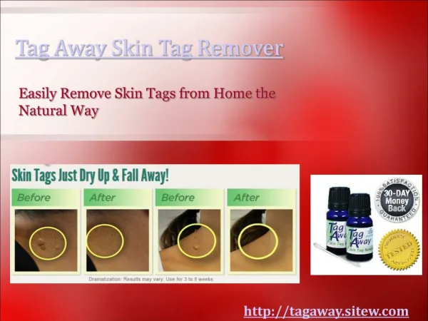 Tag Away Proving to be the Best Home Remedy for Skin Tags
