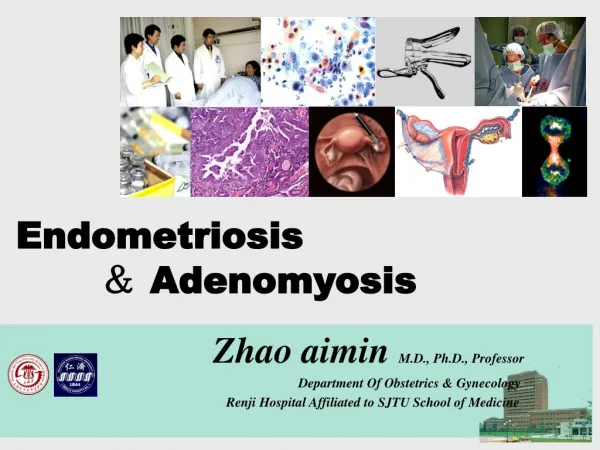 Endometriosis ? Adenomyosis