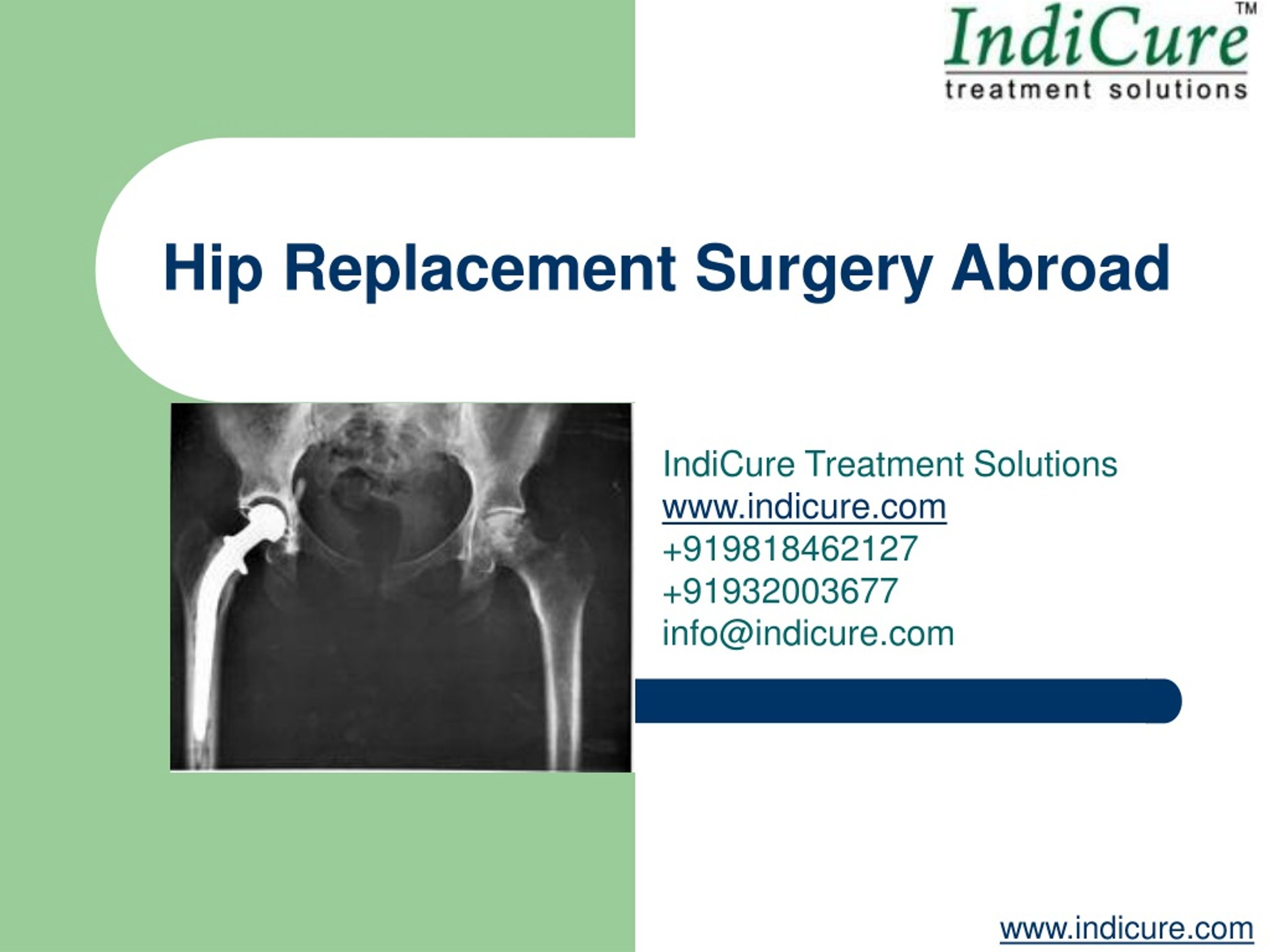 PPT - Hip Joint Replacement Surgery Abroad PowerPoint Presentation ...