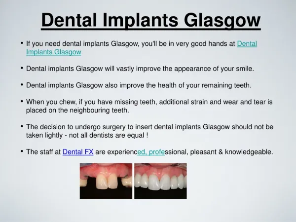 Dental Implants Glasgow