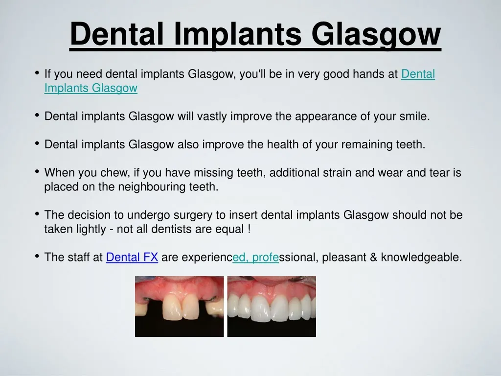 Ppt Dental Implants Glasgow Powerpoint Presentation Free Download Id