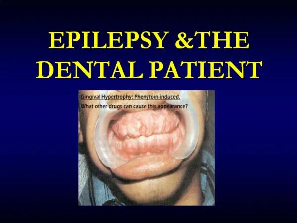 EPILEPSY THE DENTAL PATIENT