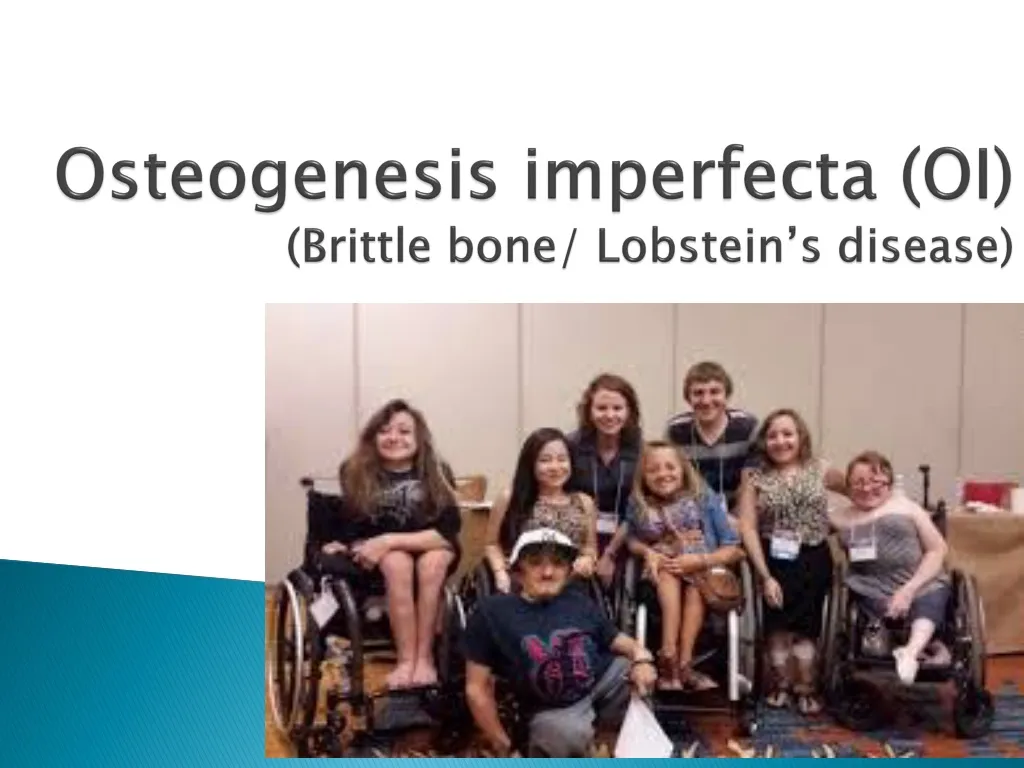 osteogenesis imperfecta oi brittle bone lobstein s disease