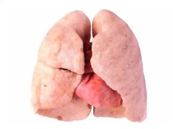 What Does Tar Do To Your Lungs