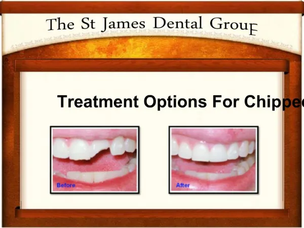 Chipped Teeth Treatment Choices