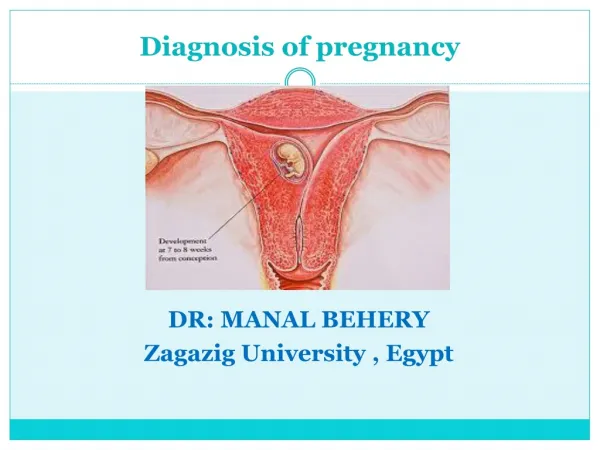 Diagnosis of pregnancy &antenal care for undergraduate