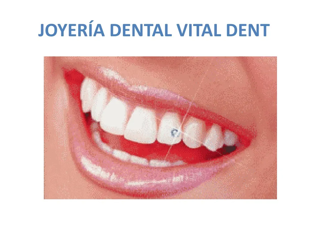 joyer a dental vital dent