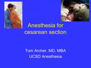 Anesthesia for cesarean section - slide 1