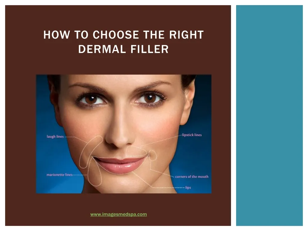 how to choose the r ight dermal f iller