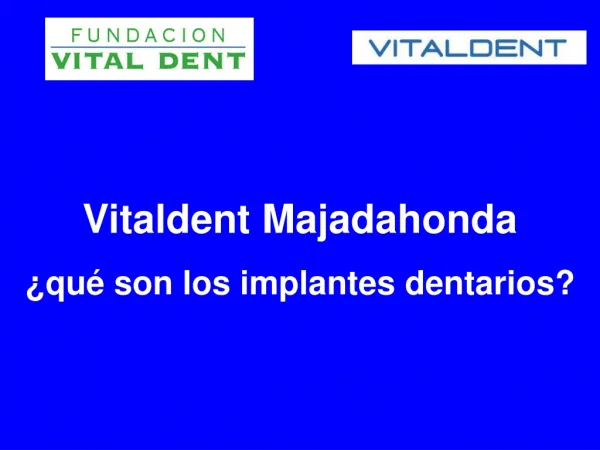 Los implantes dentales en Vitaldent Majadahonda