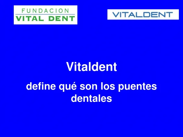 Vitaldent define qué son los puentes dentales
