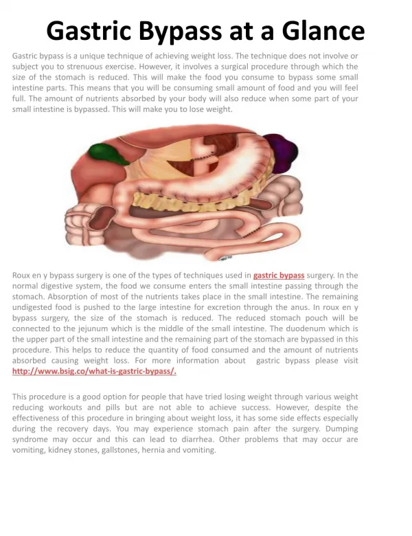 Gastric Bypass at a Glance