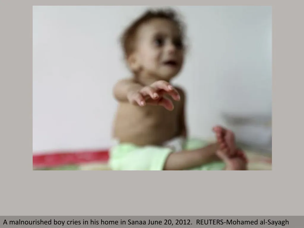 a malnourished boy cries in his home in sanaa