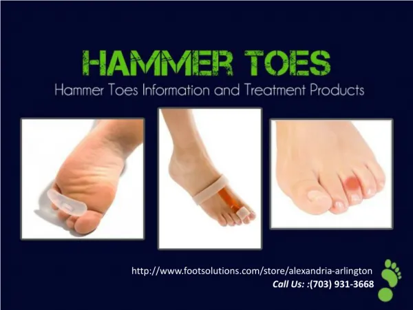 Hammer Toes Information And Treatments