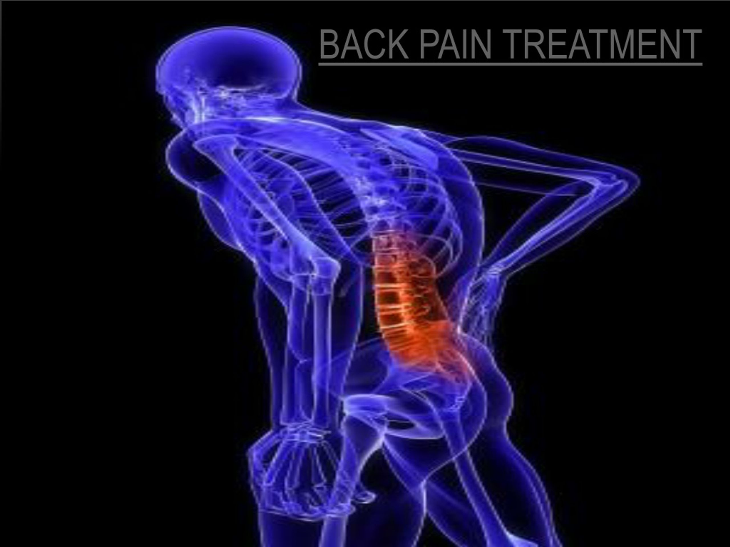 PPT - Back Pain Treatment PowerPoint Presentation, free download - ID ...