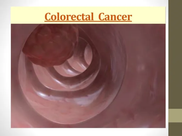 Colorectal Cancer