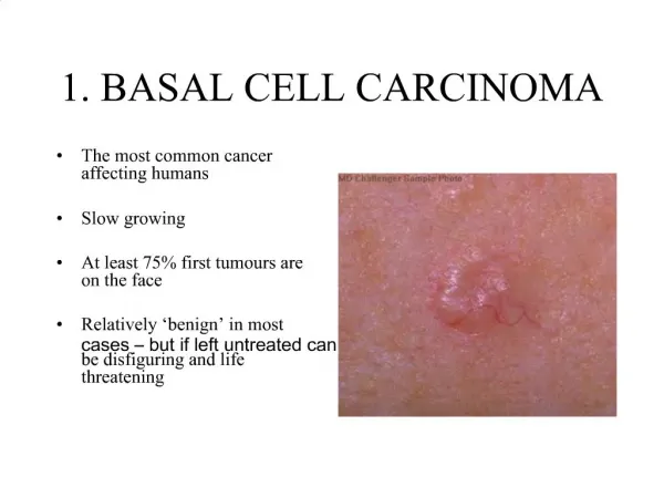 1. BASAL CELL CARCINOMA