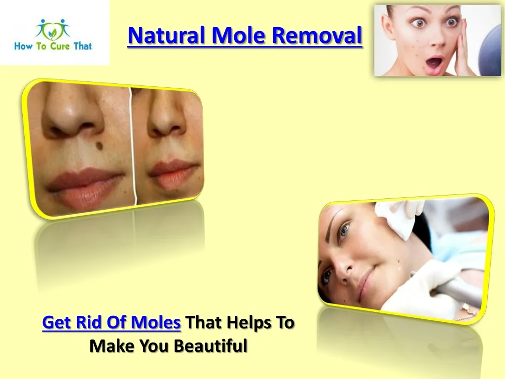 natural mole removal