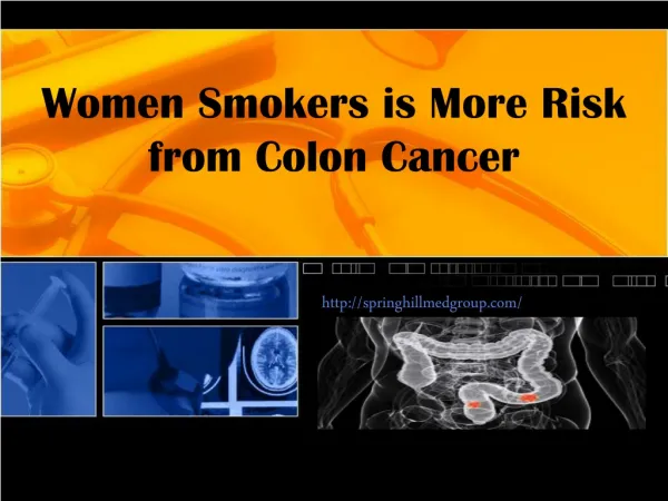 Women Smokers is More Risk from Colon Cancer - Springhill Me