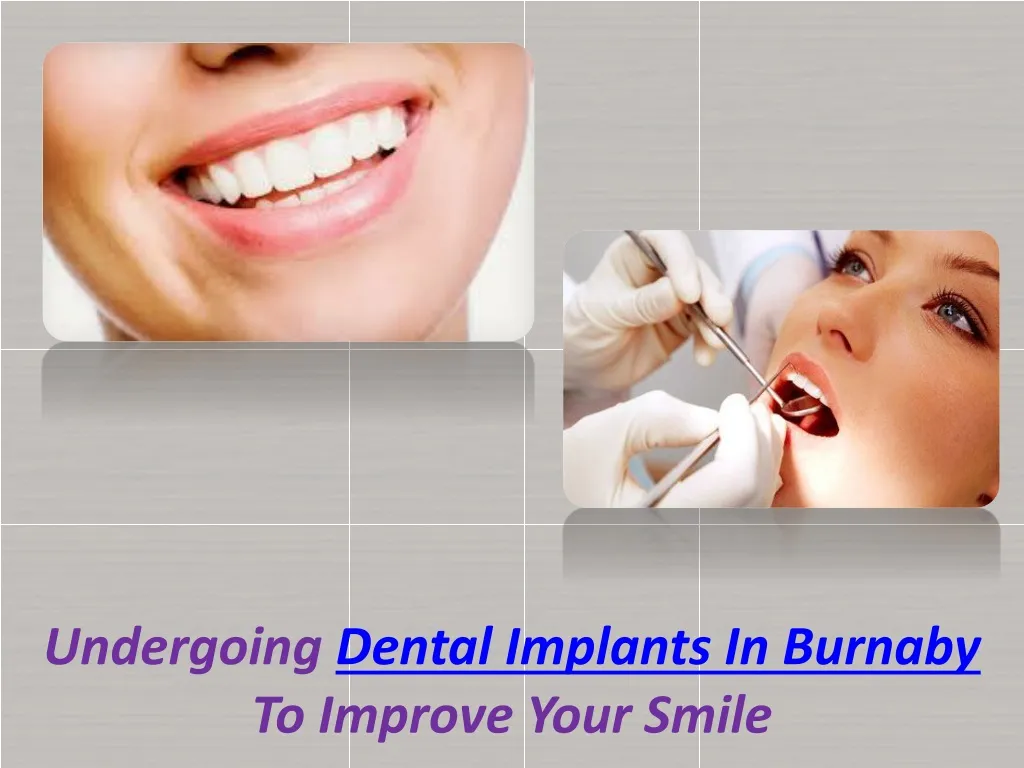 undergoing dental implants in burnaby to improve