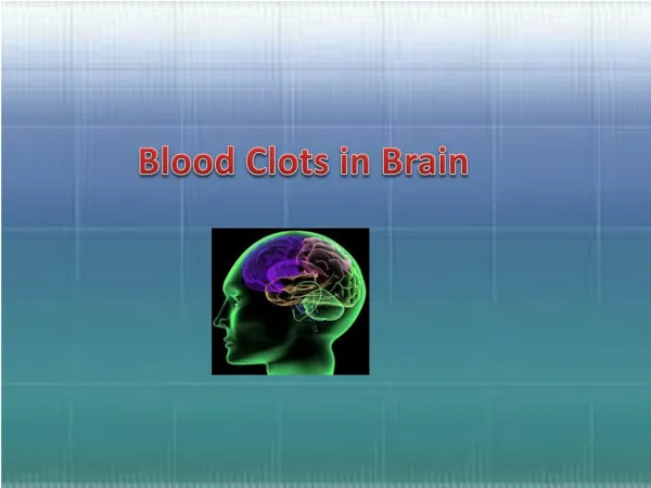 Blood Clots in Brain