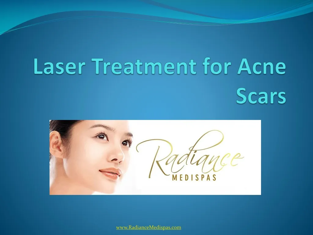 laser treatment for acne scars