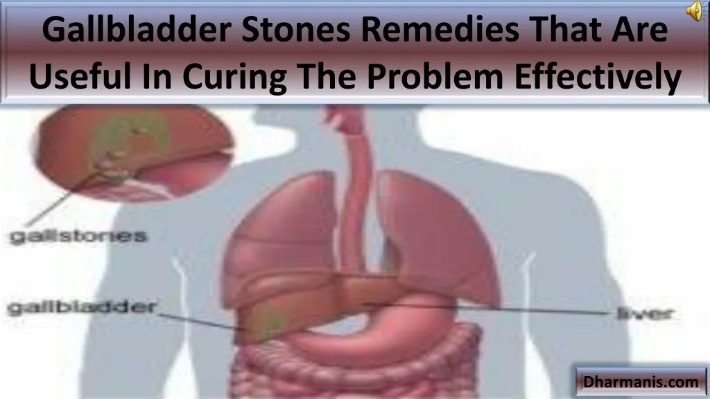 gallbladder stones remedies that are useful