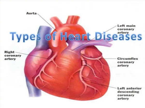 Different types of Heart Disease