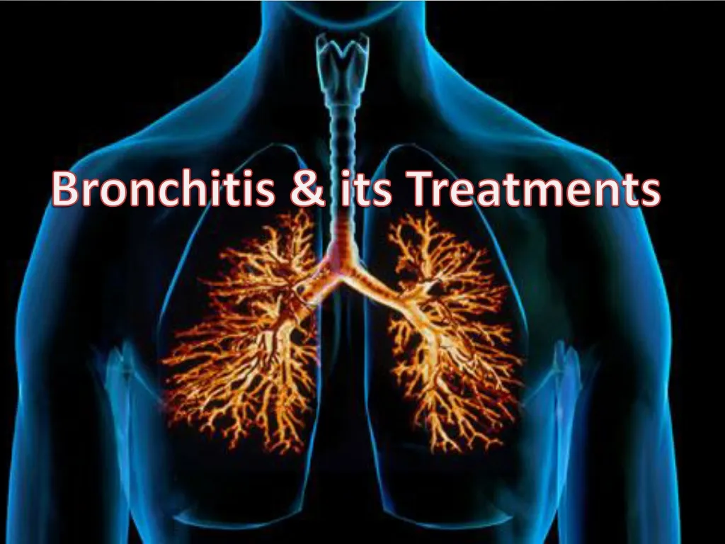 bronchitis its treatments