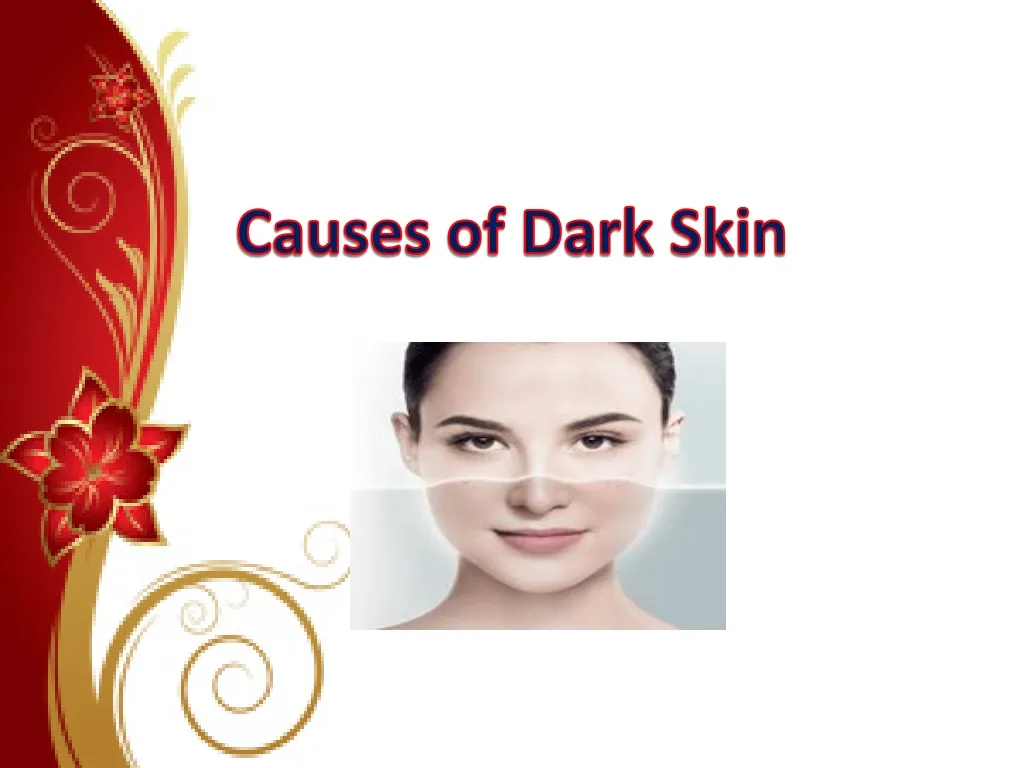 causes of dark skin