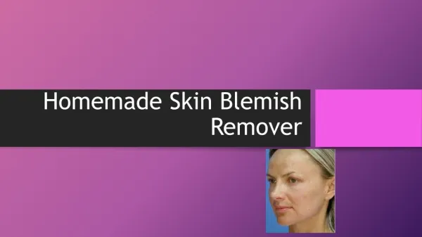 home remedy skin blemish