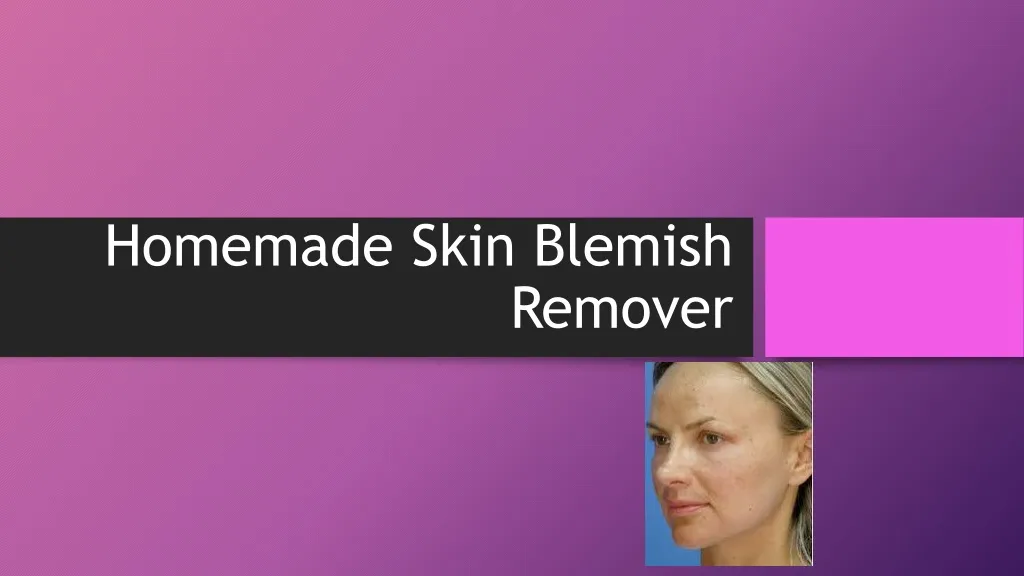 homemade skin blemish remover