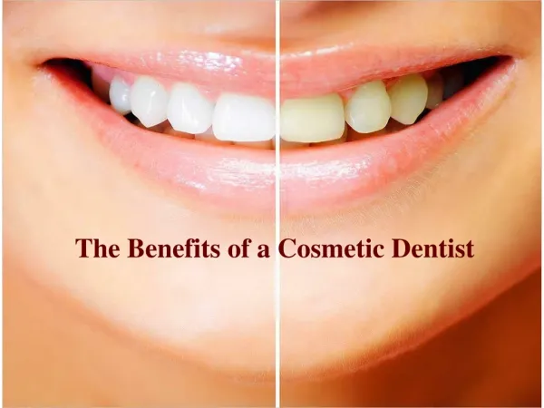 The Benefits of a Cosmetic Dentist