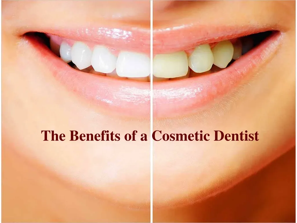 the benefits of a cosmetic dentist