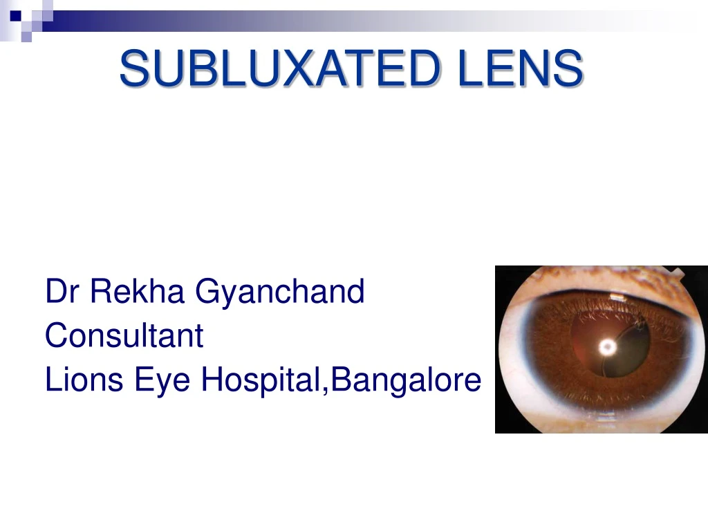 subluxated lens