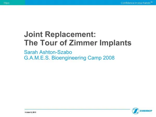Joint Replacement: 
The Tour of Zimmer Implants
