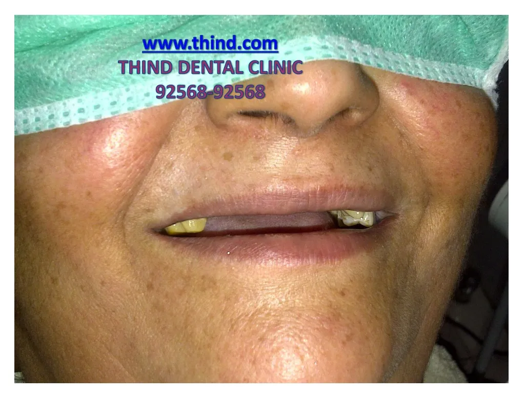 www thind com thind dental clinic 92568 92568