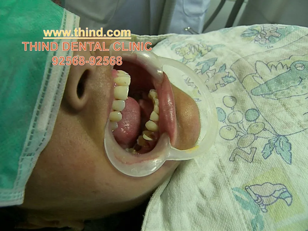 www thind com thind dental clinic 92568 92568