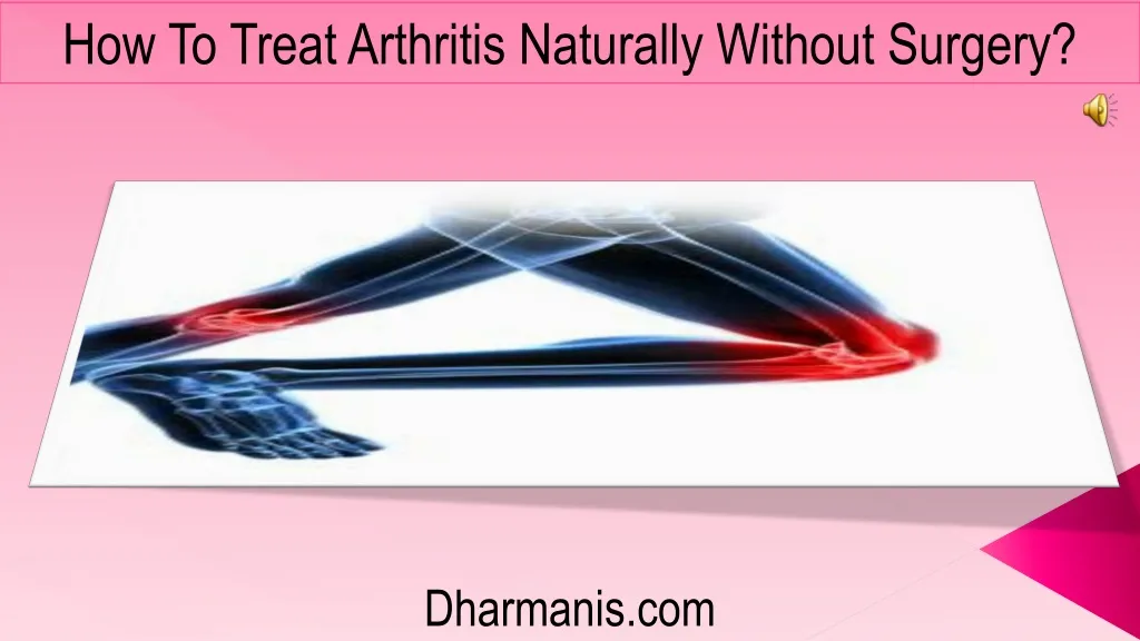 how to treat arthritis naturally without surgery