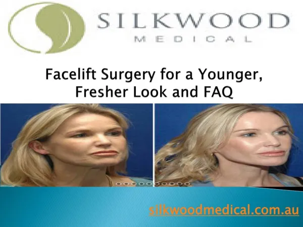 Facelift Surgery for a Younger, Fresher Look and FAQ