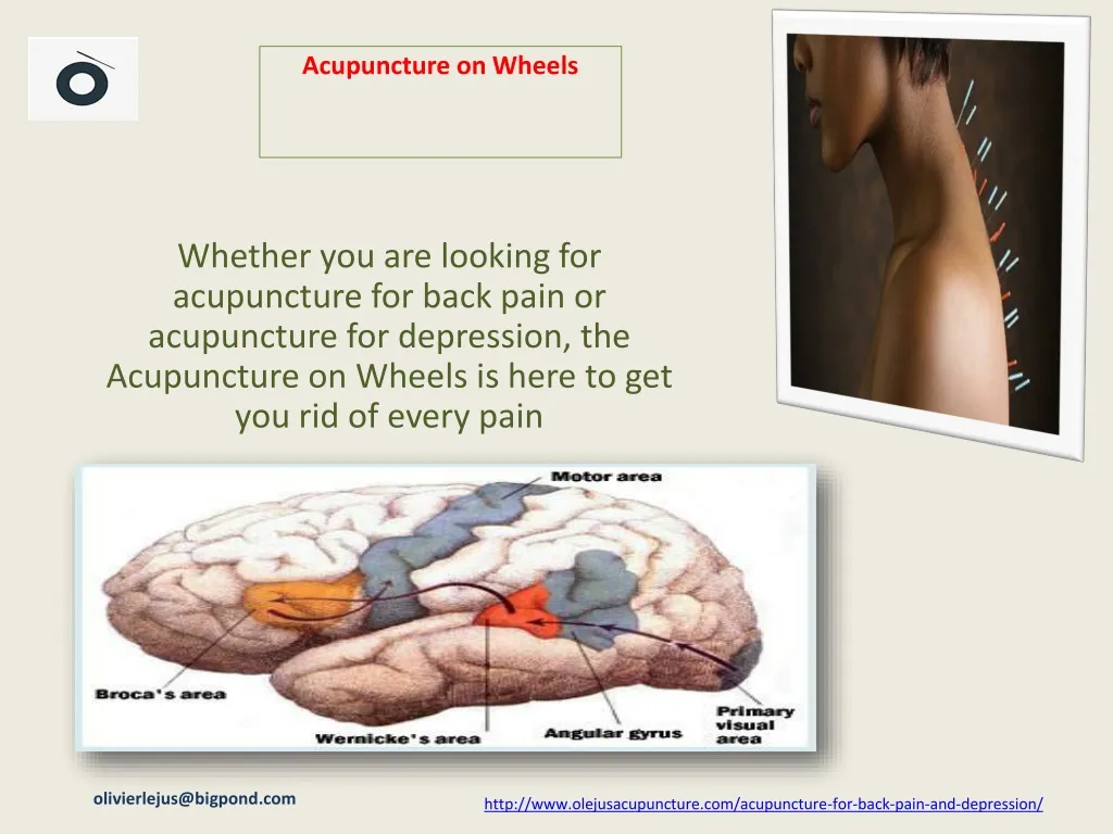 acupuncture on wheels