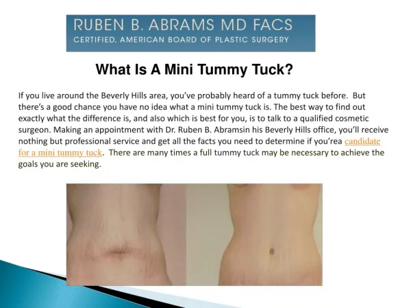 What Is A Mini Tummy Tuck?