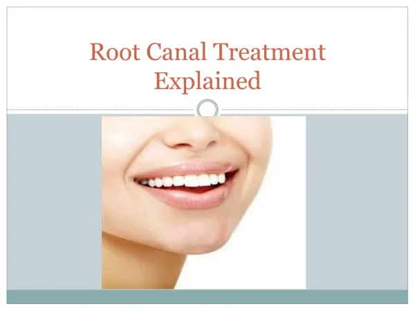 Exceptional Root Canal Treatment in Miami