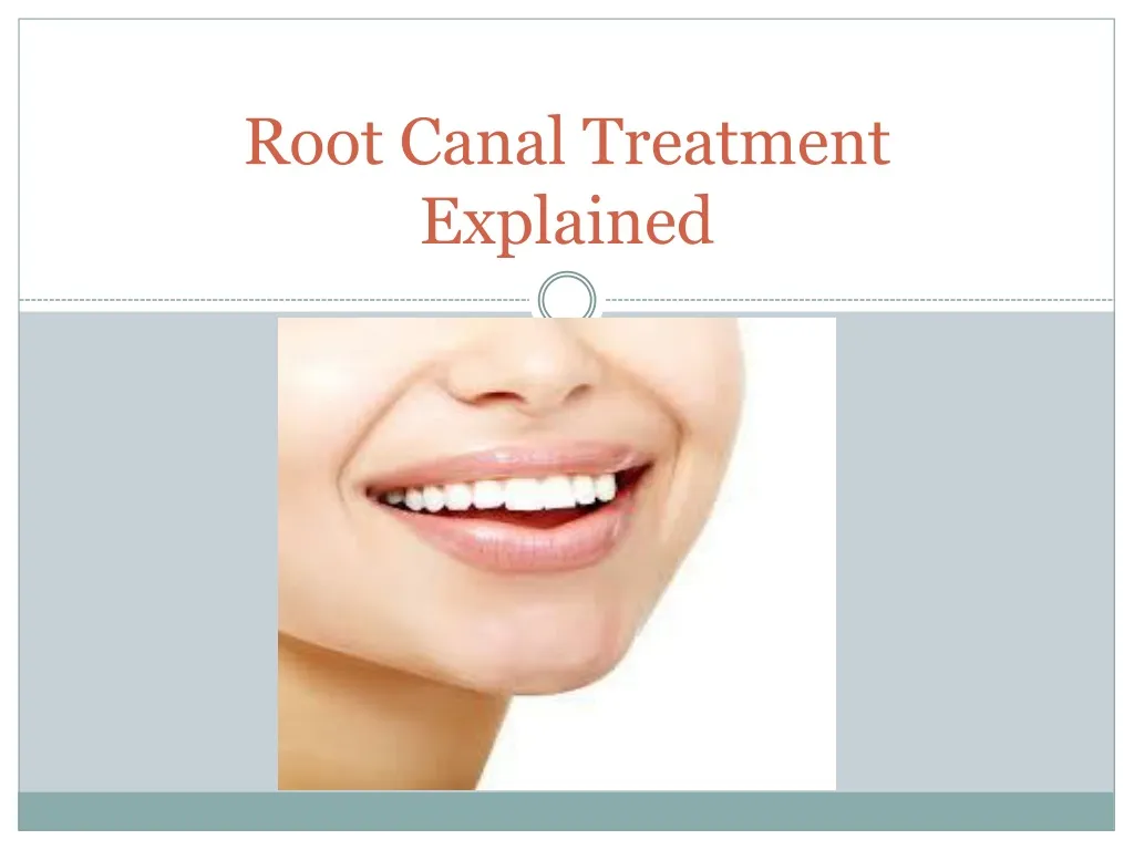 root canal treatment explained