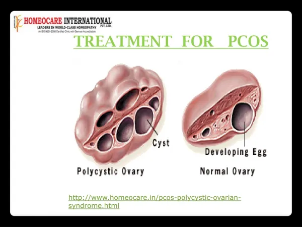 PCOS cure