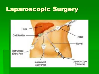 Laparoscopic Surgery - slide 1