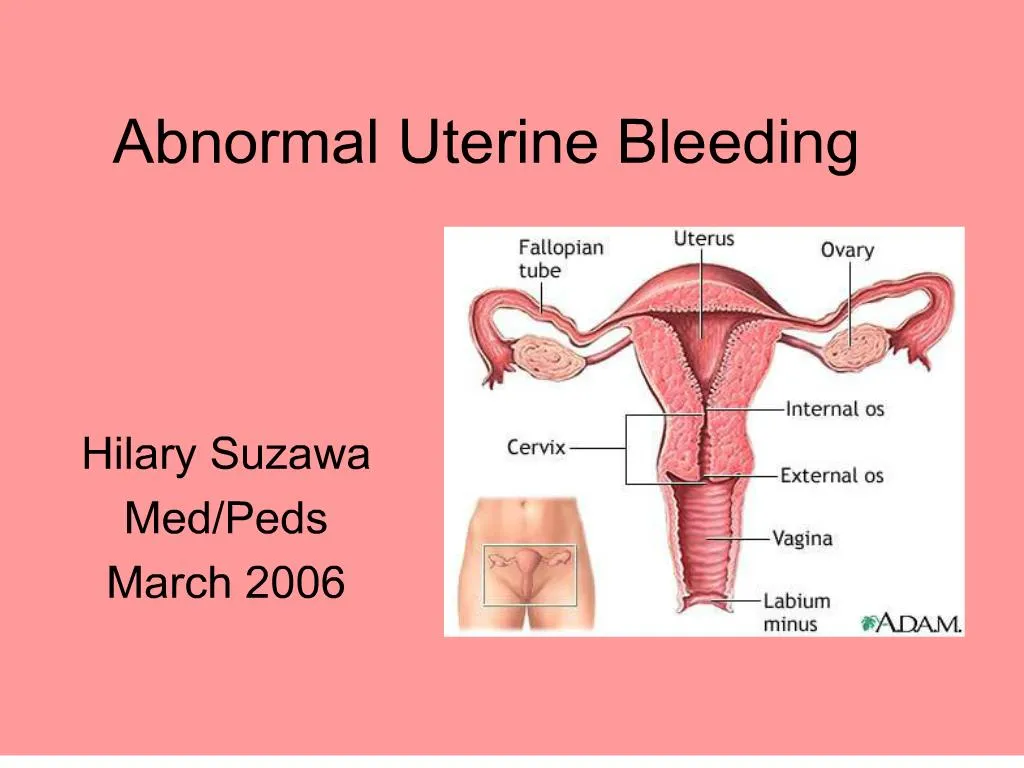 Ppt Abnormal Uterine Bleeding Powerpoint Presentation Free Download Id139174