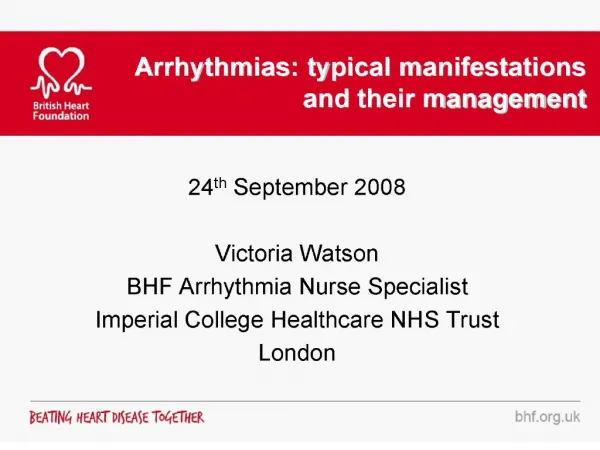 arrhythmias: typical manifestations and their management